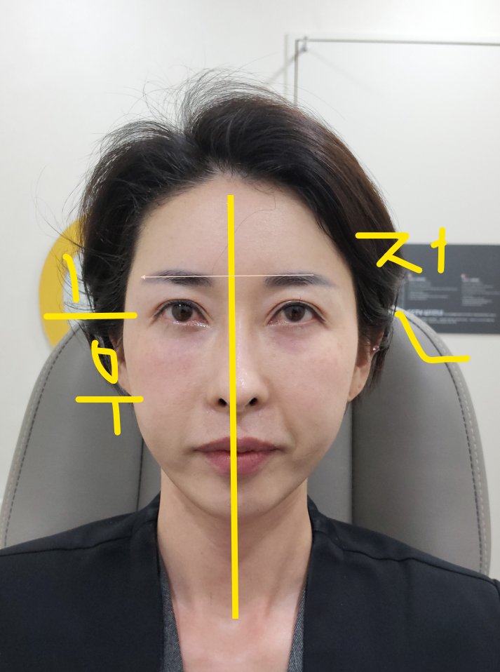 명동울쎄라피프라임